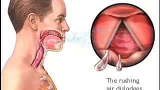 How Do We Cough  The Mechanism of Coughing  Cough Reflex Animation  Learn Human Body [upl. by Gilchrist]