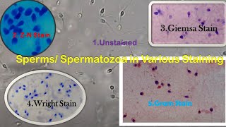 Sperms or Spermatozoa in unstained smear Gram staining Giemsa Staining Wright staining ZN stain [upl. by Zena]