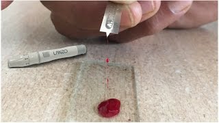 Blood Clotting time test capillary method tube and slide method coagulation profile lecture 3 [upl. by Lartnom]