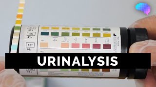 Urinalysis  OSCE Guide old version  UKMLA  CPSA [upl. by Eimrots]