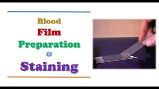 Hematology  Blood Film Preparation amp Staining [upl. by Ynatirb]