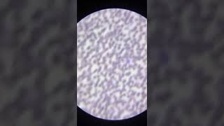 Produção de Lâminas de Sangue e Observação das Células biologia microscopia hemograma [upl. by Dressel]