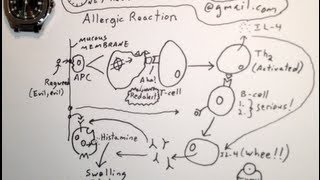 How Allergies Develop  One Minute Medical School [upl. by Spalla]