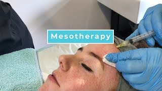 Mesotherapy With Anna [upl. by Nevin873]