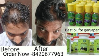 New Regrowth Hair Oil ampNeo Hair Paste For Alopecia and Stopped Hair Fall [upl. by Arliene]