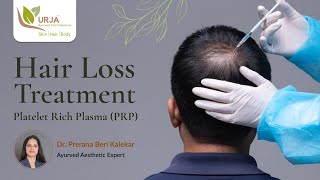 Hair Restoration using Platelet Rich Plasma  Step by Step PRP Treatment for Hair  Dr Prerana Beri [upl. by Bern]