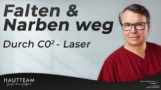 Falten und Narben loswerden  CO2 Laser als Lösung [upl. by Onibas400]