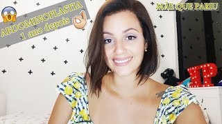 Diário da Minha Cirurgia Plástica  ABDOMINOPLASTIA depois de 1 ano [upl. by Kaia]