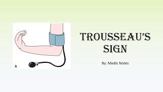 Trousseaus sign causes and pathophysiology  hypocalcemia respiratory alkalosis hypomagnesemia [upl. by Algy]