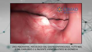 Endoscopia Bariatrica Gastroplastica Verticale Endoscopica con Apollo Overstitch [upl. by Scherman30]