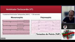 Tachyarrhythmias  Bradyarrhythmias [upl. by Adlemy]