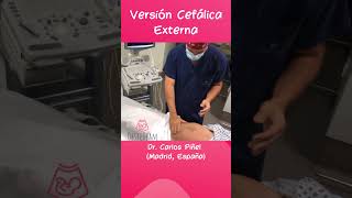 Versión Cefálica Externa para bebés de nalgas shorts obstetricia parto cesarea versionexterna [upl. by Don]