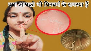 सिर्फ 1 रात मे Pinworms होगा खत्म  How to get rid of Pinworms  Threadworms treatment at home [upl. by Gnilyam753]