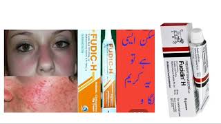 fucidin H cream usesSide EffectsDosage review in Hindi or Urdu [upl. by Whitelaw]