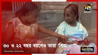 ৩০ ও ২২ বছর বয়সেও তারা শিশু  Chuadanga  Putul Meye  Deepto News [upl. by Nihhi]