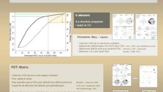 Surveillance du glaucome  Champ Visuel May F [upl. by Alemac451]