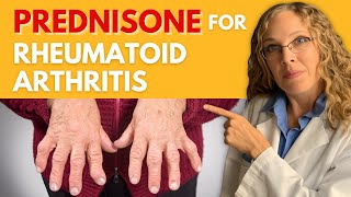 Managing Rheumatoid Arthritis with Prednisone Dosage Effectiveness and Side Effects [upl. by Elvia145]