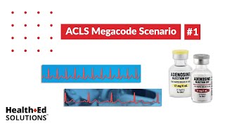 ACLS Megacode Scenario 1 Supraventricular Tachycardia SVT [upl. by Novrej640]