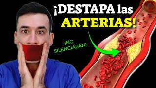 DESTAPA LAS ARTERIAS ¡SIN REMEDIOS [upl. by Killarney622]