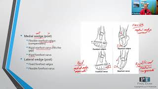 Forefoot and Rearfoot Deformities [upl. by Ettenyar161]