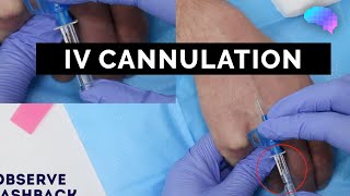 Intravenous IV cannulation  OSCE Guide  UKMLA  CPSA [upl. by Nnyladnarb]