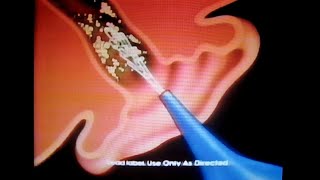 Murine Ear Wax Removal System commercial Family Channel March 10 1992 [upl. by Eilis]