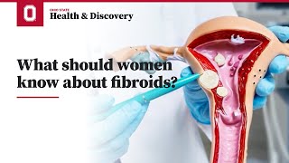 What should women know about fibroids  Ohio State Medical Center [upl. by Wier]