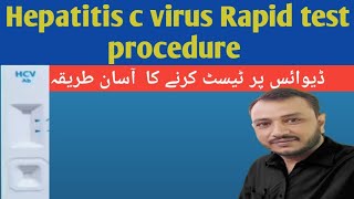 Hcv test procedure Hepatitis c virus test [upl. by Homovec]