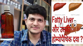 Fatty liver  Homeopathic Medicine for Fatty liver  My Combination [upl. by Mckenna202]