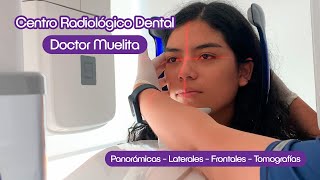 🦷 Ahora en Doctor Muelita contamos con nuestro propio CENTRO RADIOLÓGICO DENTAL [upl. by Einafets]