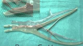 MediFax This Week in Neurosurgery  Surgical Instruments for Lumbar Spine [upl. by Atteras]