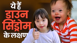 Down Syndrome Symptoms बच्चों में दिखने वाले ये लक्षण हो सकते हैं डाउन सिंड्रोम के [upl. by Tse189]