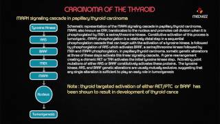 Usmle pathology webinar on Thyroid Neoplasms  Benign and Malignant types in Detail [upl. by Jeffy890]