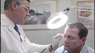 Skin Cancer check up and screening [upl. by Darce]