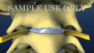 Cervical Spine and Intervertebral Disc Anatomy  Male Version [upl. by Clorinda]