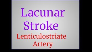 Lacunar Stroke [upl. by Stefania265]