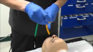 Nasal Intubation [upl. by Verlie]