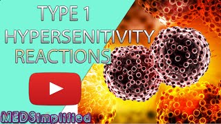 Hypersensitivity Type 1 Reactions Made Easy Type 1 Allergic Reaction [upl. by Rehposirhc285]