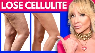 How To Get Rid Of Cellulite For Good  ScienceBacked Ways [upl. by Oiretule]