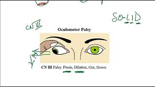 Video 220 Ocular Muscle Innervation amp Cranial Nerve Lesions Anatomy Function amp Clinical Correlates [upl. by Graniela]