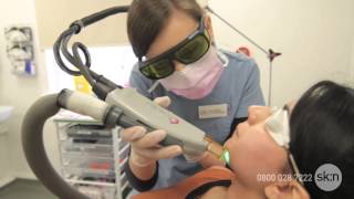 Laser Hair Removal  How does it work [upl. by Aicilla]