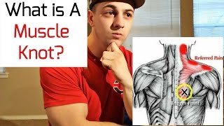 What is a Muscle Knot [upl. by Cathee]