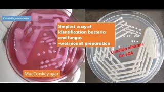 A very simple Saline wet mount techniue help you to identify yeast cells of candida from bacteria [upl. by Ttej]