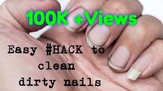 Nail Cleaning  how to remove dirt from nails easyhack [upl. by Lapides]