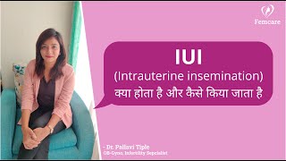 What is IUI amp How it is done IUI कैसे किया जाता है  Intrauterine insemination  Dr Pallavi [upl. by Naloj]