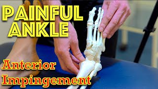 Ankle Pain  Anterior Impingement  Dr Gill [upl. by Nwahsuq]