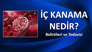 İÇ KANAMA BELİRTİLERİ VE TEDAVİSİ [upl. by Anij314]