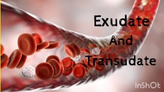 Exudate and Transudate  Basic Pathology [upl. by Schnur]