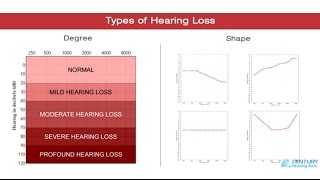 2 Types of Hearing Loss [upl. by Peg652]