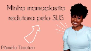 MAMOPLASTIA REDUTORA PELO SUS  COMO CONSEGUIR PÂMELA TIMOTEO [upl. by Nic650]